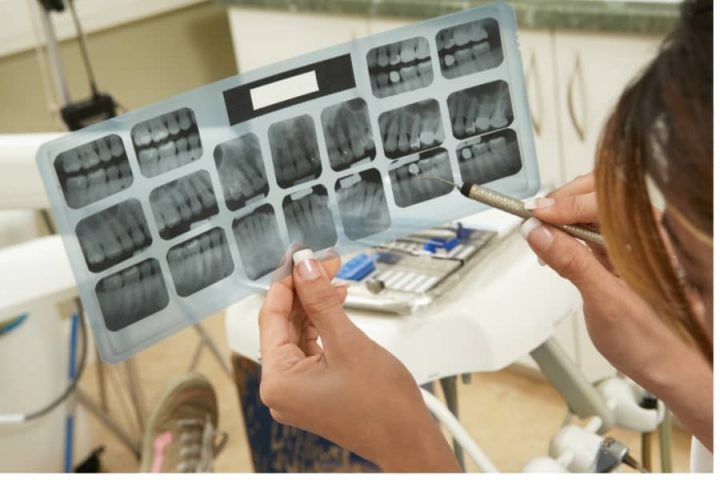 San Marcos Family Dentistry- Dentist examining a patient's X-rays