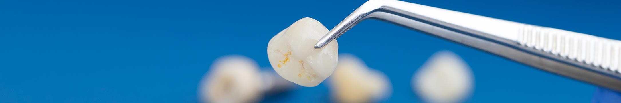 Dentist using tweezers to hold dental crowns for dental care in San Marcos TX